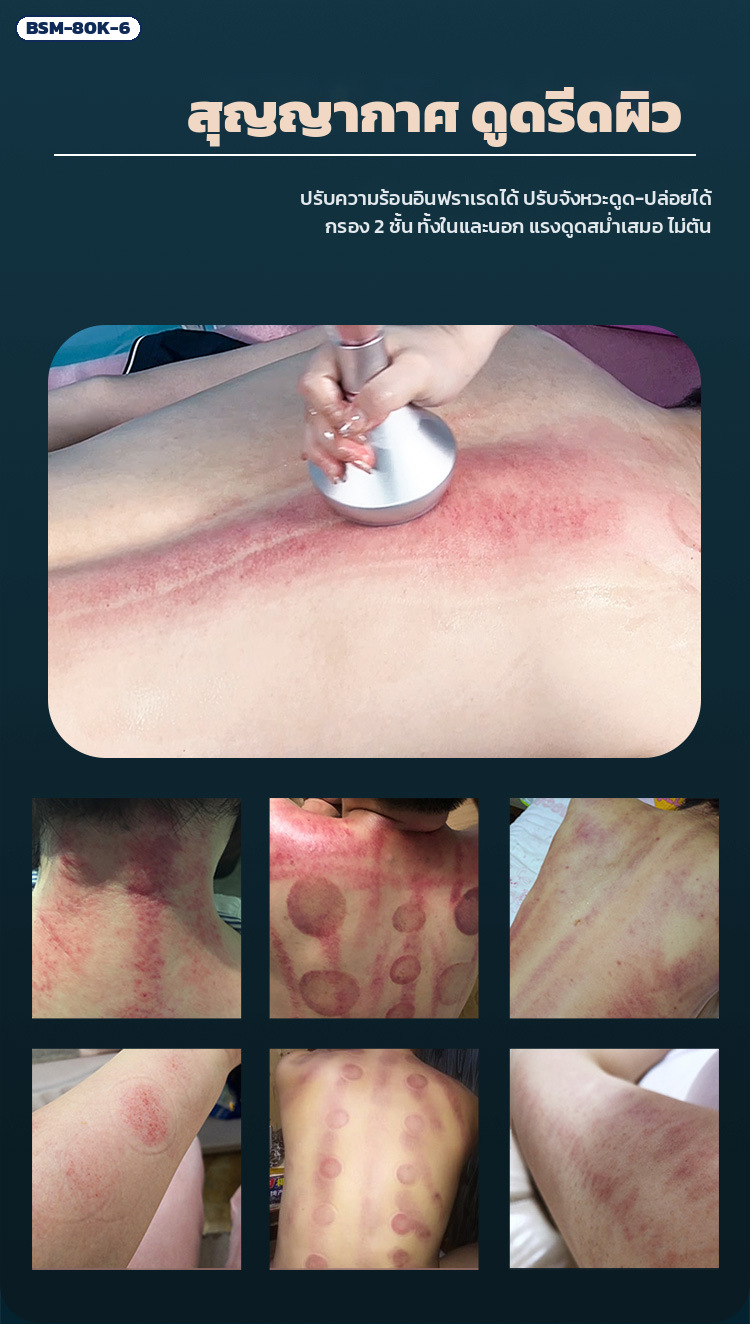 เครื่องดูแลผิวหน้าและเรือนร่าง 80K รุ่น 6 หัวในเครื่องเดียว RF / 80K / สุญญากาศ / BIO&LED / หัวเย็น จอสัมผัส - Image 7